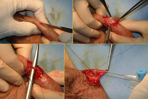 Quali esami sono necessari per diagnosticare l’infertilità maschile ? — Infertilità