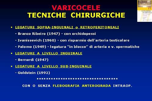 Microchirurgia del varicocele