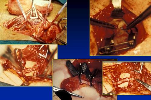 Quali esami sono necessari per diagnosticare l’infertilità maschile ? — Infertilità