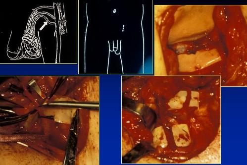 Quali esami sono necessari per diagnosticare l’infertilità maschile ? — Infertilità