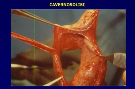 Terapia del tumore prostatico — figura 78