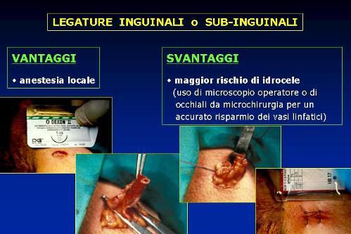 Quali esami sono necessari per diagnosticare l’infertilità maschile ? — Infertilità