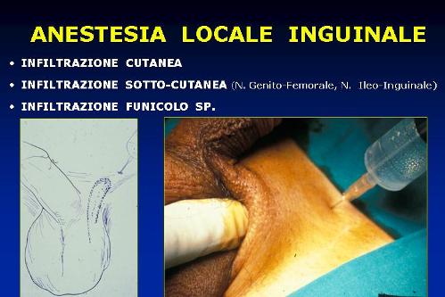 Quali esami sono necessari per diagnosticare l’infertilità maschile ? — Infertilità