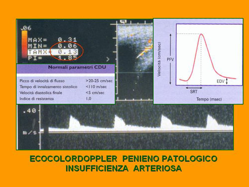 Quali esami sono necessari per diagnosticare la D.E. ? — Disfunzione erettile