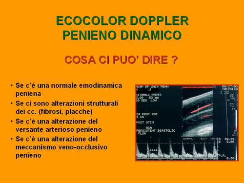 Quali esami sono necessari per diagnosticare la D.E. ? — Disfunzione erettile