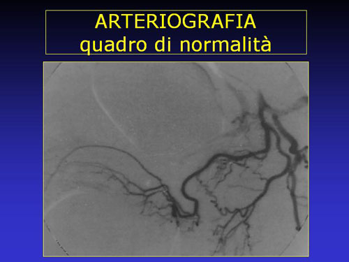 Quali esami sono necessari per diagnosticare la D.E. ? — Disfunzione erettile
