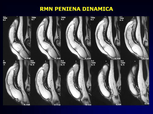 Quali esami sono necessari per diagnosticare la D.E. ? — Disfunzione erettile