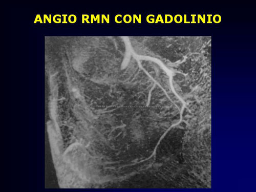 Quali esami sono necessari per diagnosticare la D.E. ? — Disfunzione erettile