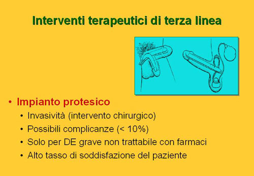 Quali possibilità di cura esistono oggi per la D.E. ? — Disfunzione erettile