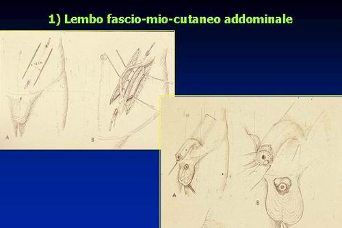 Disturbi di Genere