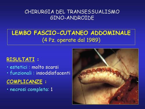 (Clitoridofallopessia sec.Austoni) — Falloplastica