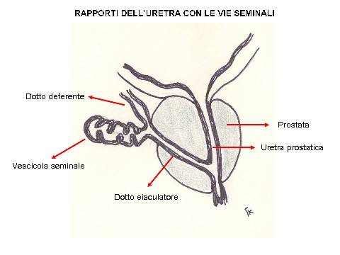 POSTERIORE: Membranosa, Prostatica — Stenosi uretrali