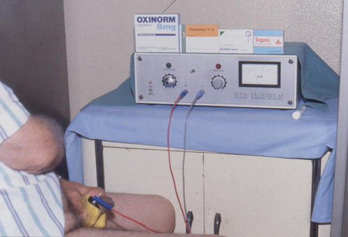 Quali possibilità di cura esistono oggi per l'IPP ? — Pene Curvo – Malattia di La Peyronie