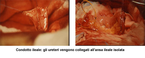 Terapia del tumore della vescica — figura 27