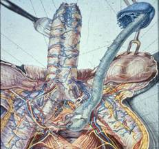 Terapia . — Terapia del tumore del pene