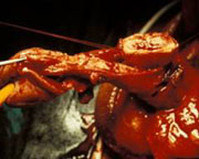 "GLANDULECTOMIA NERVE SPARING"(Austoni1994) — Terapia del tumore del pene