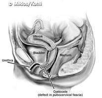 Definizione — Urodinamica