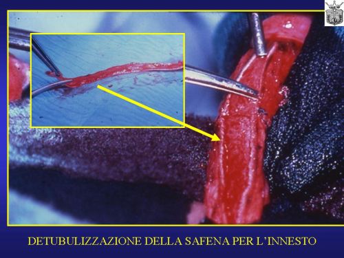 Micropene — Malformazioni congenite